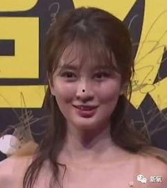 明星填充过度,揭秘整形美容的利与弊
